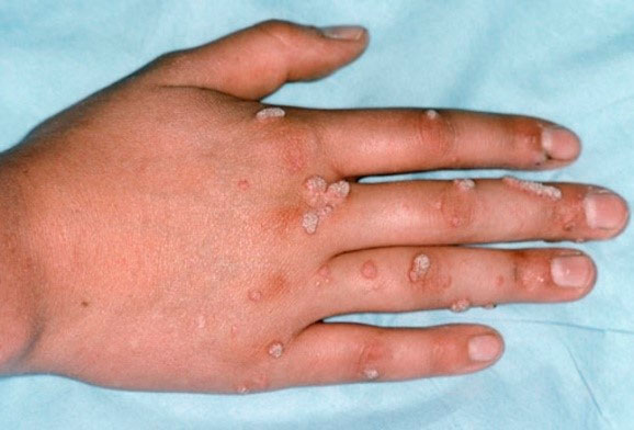 Best of Doctor handjob