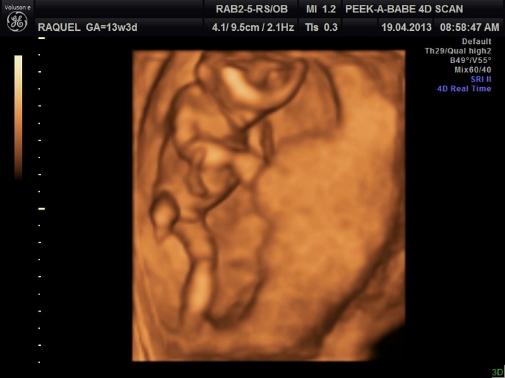 porn ultrasound - pants on porn teens pegging